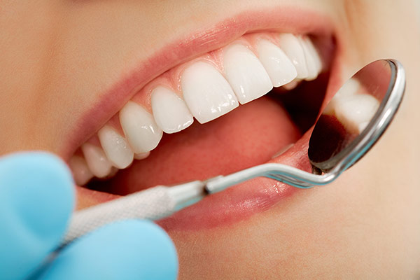 A dentist using a mirror to look closely at a patient’s teeth after tooth restoration.