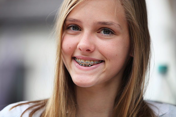 A young girl with new braces
