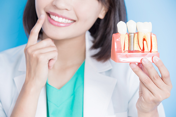 Dentist holding a large model of a tooth implant for correcting tooth loss.