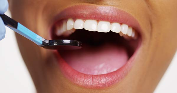 A woman being checked for cavities.