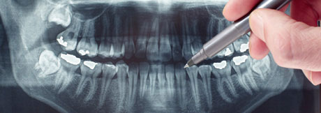 Pointe Dental Group uses digital X-rays to reduce radiation exposure
