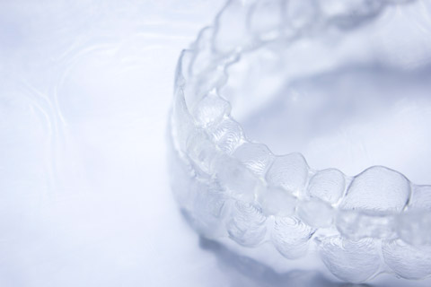 How Long Does Invisalign Take?